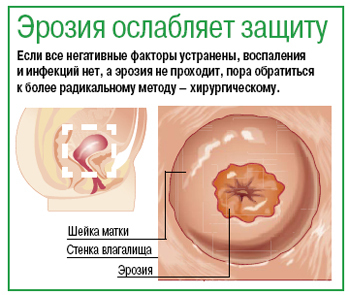 zdes erozii virus analiz na sdat papilloma pri bravo eta velikolepnaya Сдать анализ на папиллома вирус при эрозии фото
