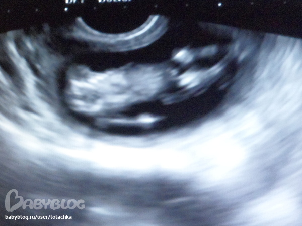 Как считаются недели беременности в гинекологии