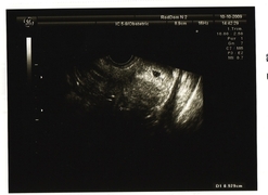 our_first_photo:)
