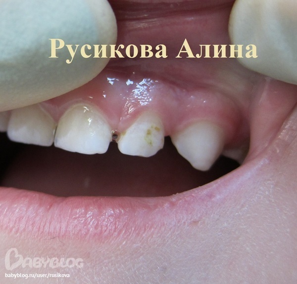 30ffe7004fd33d5f56c52549524e0b6d.jpg