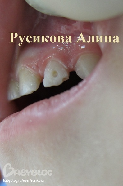 39ddb9dc30990b2e7bf493ac6dd8cfdb.jpg