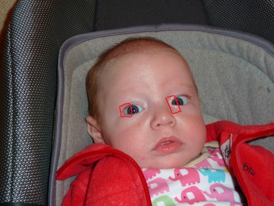 Почему у новорожденного ребенка косые глаза