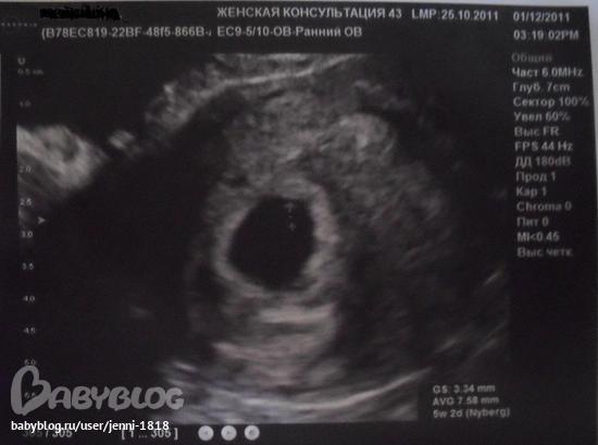 Почему не видно эмбрион. Эмбрион 6 акушерских недель УЗИ. 6 Акушерских недель беременности на УЗИ. УЗИ снимок на 6 акушерской неделе.