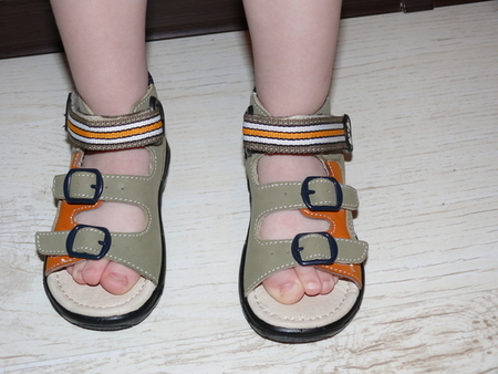 Обувь при вальгусной стопе у ребенка