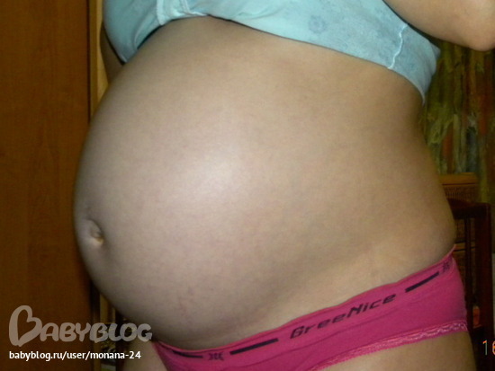 33 недели назад. Растяжки на животе на 32 неделе. Растяжки на животе 40 неделя. Живот на 33 неделе беременности мальчиком.