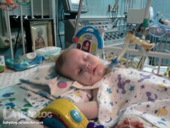 последствия вакуума. последствия вакуума. осложнения вакуум экстракции. вакуумный аборт противопоказания. последствия вакуума.