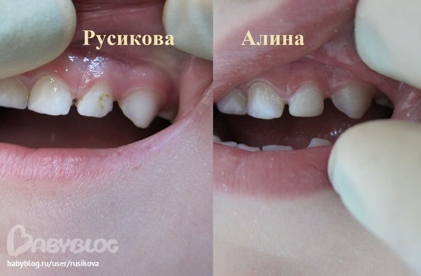 ffb708c2c3c39d3366b077ada7c5f925.jpg